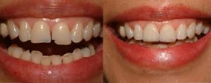 Cosmetic Dentistry1