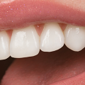 Cosmetic Dentistry