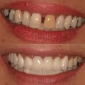 Cosmetic Dentistry