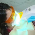 Bleaching and Tooth whitening