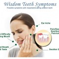 Wisdom tooth surgery